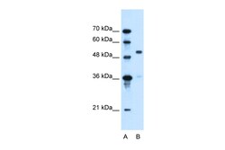 Aviva Systems Biology Corp SLC37A3 Antibody - middle region (ARP44064_P050)
