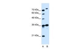 Aviva Systems Biology Corp SLC9A7 Antibody - N-terminal region (ARP44066_P050)