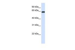 Aviva Systems Biology Corp SLC39A4 Antibody - N-terminal region (ARP44090_P050)
