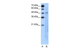Aviva Systems Biology Corp SLC25A46 Antibody - N-terminal region (ARP44094_T100)