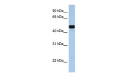 Aviva Systems Biology Corp SLC25A46 Antibody - C-terminal region (ARP44095_P050)