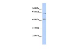 Aviva Systems Biology Corp SLC22A12 Antibody - N-terminal region (ARP44102_P050)