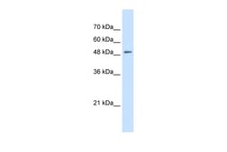 Aviva Systems Biology Corp SLC43A2 Antibody - N-terminal region (ARP44116_P050)