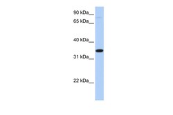 Aviva Systems Biology Corp SLC44A3 Antibody - middle region (ARP44120_P050)