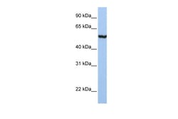 Aviva Systems Biology Corp SLC39A5 Antibody - N-terminal region (ARP44143_P050)