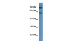 Aviva Systems Biology Corp Slc6a15 Antibody - middle region (ARP44162_P050)