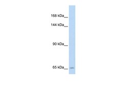 Aviva Systems Biology Corp SLC19A1 Antibody - N-terminal region (ARP44167_T100)