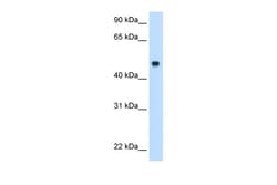 Aviva Systems Biology Corp C8B Antibody - middle region (ARP44210_P050)