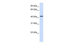Aviva Systems Biology Corp HSD3B2 Antibody - N-terminal region (ARP44239_P050)