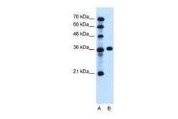 Aviva Systems Biology Corp PTCH1 Antibody - C-terminal region (ARP44249_P050)