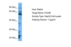 Aviva Systems Biology Corp CY24B Antibody - C-terminal region (ARP44276_P050)