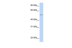Aviva Systems Biology Corp UGT1A1 Antibody - N-terminal region (ARP44292_P050)