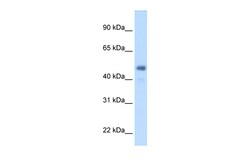 Aviva Systems Biology Corp FGG Antibody - middle region (ARP44300_T100)