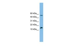 Aviva Systems Biology Corp EPO Antibody - middle region (ARP44337_P050)