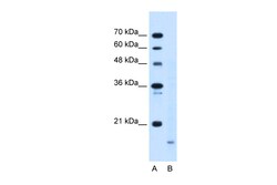Aviva Systems Biology Corp PPIB Antibody - middle region (ARP44365_T100)