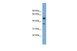Aviva Systems Biology Corp ATP1B1 Antibody - N-terminal region (ARP44410_P050)