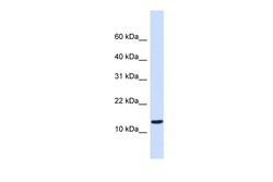 Aviva Systems Biology Corp STUM Antibody - middle region (ARP44446_P050)