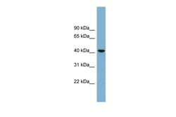 Aviva Systems Biology Corp B4GALT2 Antibody - middle region (ARP44505_P050)