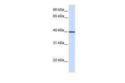 Aviva Systems Biology Corp GP2 Antibody - middle region (ARP44543_P050)