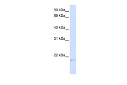Aviva Systems Biology Corp C14orf180 Antibody - middle region (ARP44555_P050)