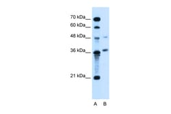 Aviva Systems Biology Corp ARMCX6 Antibody - N-terminal region (ARP44584_T100)