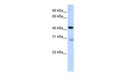Aviva Systems Biology Corp GRAMD2A Antibody - middle region (ARP44634_P050)