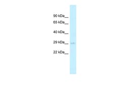 Aviva Systems Biology Corp AGPAT2 Antibody - C-terminal region (ARP44636_P050)