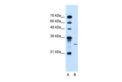 Aviva Systems Biology Corp AGPAT2 Antibody - C-terminal region (ARP44637_T100)