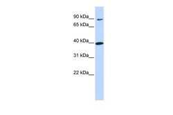 Aviva Systems Biology Corp OR11H12 Antibody - N-terminal region (ARP44646_P050)