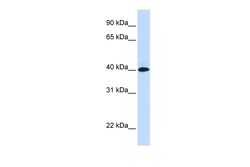 Aviva Systems Biology Corp VSIG8 Antibody - N-terminal region (ARP44665_P050)