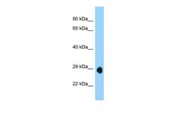 Aviva Systems Biology Corp LOC632209 ANTIBODY 50UG/50UL, Quantity: Each