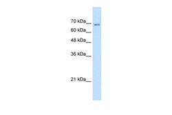 Aviva Systems Biology Corp TM9SF1 Antibody - N-terminal region (ARP44683_T100)