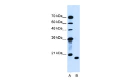 Aviva Systems Biology Corp PTRH2 Antibody - C-terminal region (ARP44695_T100)