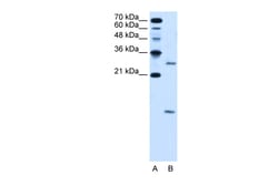 Aviva Systems Biology Corp VMA21 Antibody - N-terminal region (ARP44721_T100)