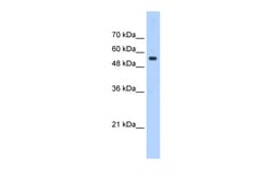 Aviva Systems Biology Corp PODXL Antibody - middle region (ARP44730_P050)