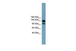 Aviva Systems Biology Corp LRRC66 Antibody - middle region (ARP44733_P050)