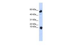 Aviva Systems Biology Corp C1orf151 Antibody - middle region (ARP44801_P050)