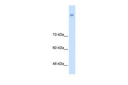Aviva Systems Biology Corp NRCAM Antibody - N-terminal region (ARP44833_T100)