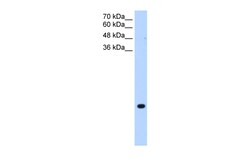 Aviva Systems Biology Corp TMEM75 Antibody - C-terminal region (ARP44839_P050)