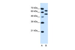 Aviva Systems Biology Corp SIL1 Antibody - N-terminal region (ARP44848_P050)