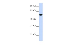 Aviva Systems Biology Corp CEACAM16 Antibody - middle region (ARP44865_P050)