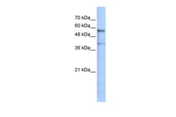 Aviva Systems Biology Corp KREMEN1 Antibody - N-terminal region (ARP44879_P050)