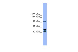 Aviva Systems Biology Corp ENPP2 Antibody - N-terminal region (ARP44907_P050)
