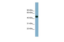 Aviva Systems Biology Corp ABHD12 Antibody - middle region (ARP44941_P050)