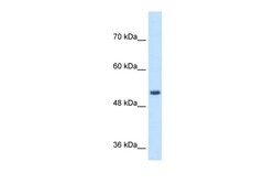Aviva Systems Biology Corp SPPL2B Antibody - N-terminal region (ARP44989_P050)