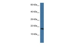 Aviva Systems Biology Corp Pnkd Antibody - N-terminal region (ARP44997_P050)
