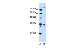 Aviva Systems Biology Corp FLJ22167 Antibody - N-terminal region (ARP45005_T100)