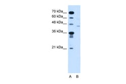 Aviva Systems Biology Corp FKTN Antibody - N-terminal region (ARP45033_T100)
