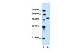 Aviva Systems Biology Corp ACVR1 Antibody - N-terminal region (ARP45040_P050)