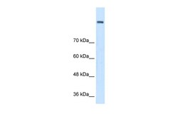 Aviva Systems Biology Corp AOC2 Antibody - middle region (ARP45055_P050)